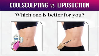 Laser Liposuction: A Safe and Efficient Solution for Fat Sculpting