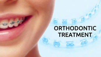 A Complete Guide to Orthodontics in the United States: Achieve Your Perfect Smile